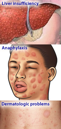 Diflucan warnings