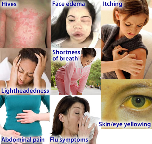 80mg propranolol alcohol 80mg propranolol alcohol