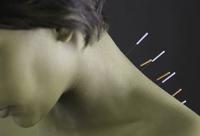 Acupuncture for fibromyalgia