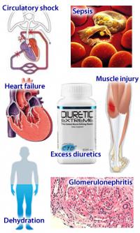 Acute renal failure causes