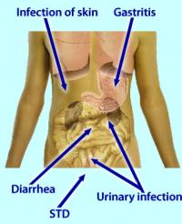 Body infections