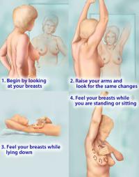 Breast self examination