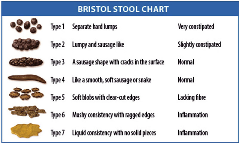 Pus Color Chart