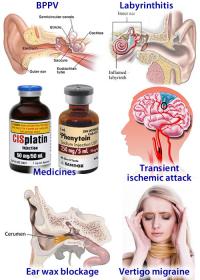 Causes of dizziness