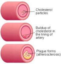 Cholesterol