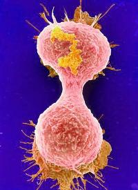 Dividing cancer cell