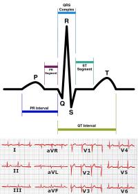 Elements of ECG