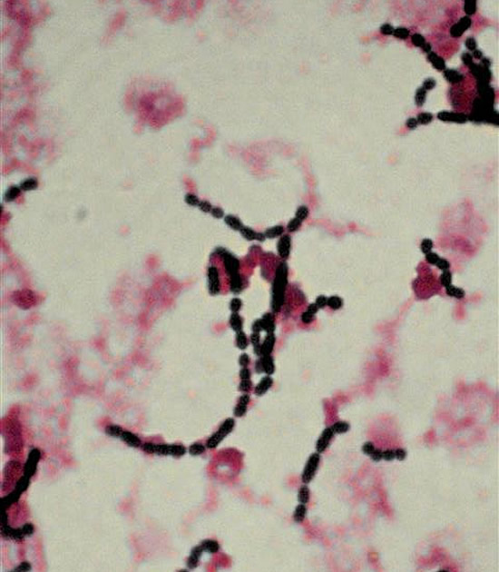 thesis on group b streptococcus