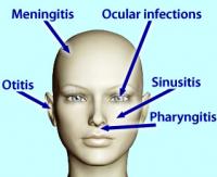 Head infections