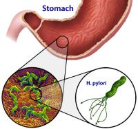 Helicobacter pylori