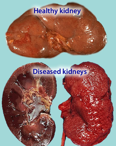 Signs liver damage steroids