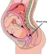 Mucus plug