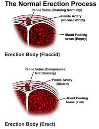 Normal erection