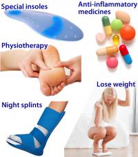 Plantar fasciitis treatment