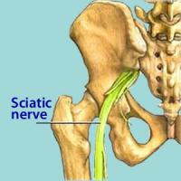 Sciatic nerve