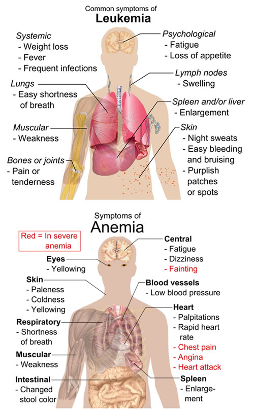 Adult Anemia 23