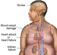 Symptoms of hypertension