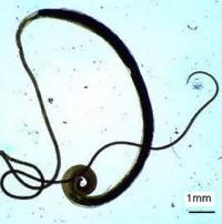 Trichuris trichiura male