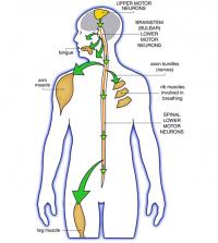 Upper and lower motor neuron