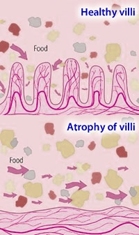 Villi