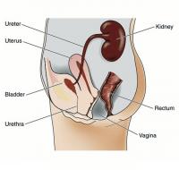 Women urinary tract