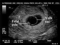 Yolk sac in ultrasound
