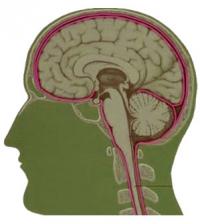 Cryptococcal meningitis