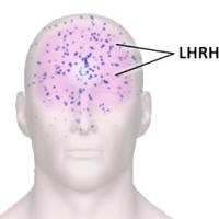 LHRH