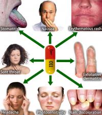 Tetracycline side effects