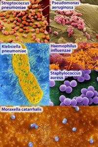 Bacteria causing pneumonia