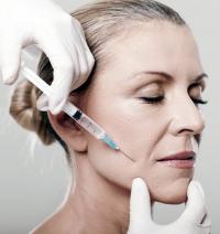 Botox injection
