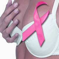Breast cancer