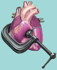 Causes of hypertension