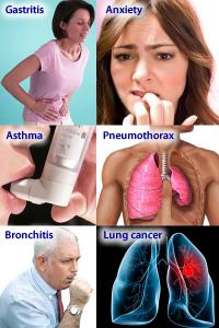 Chest pain causes