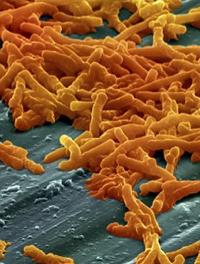 Clostridium difficile under microscope