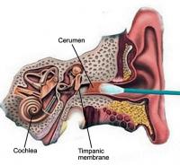 Ear wax