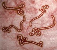 Ebola virus