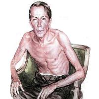Emphysema