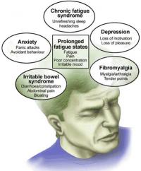Fatigue syndrome