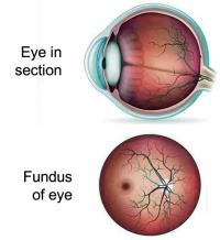 Fundus of eye