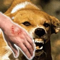 Human rabies