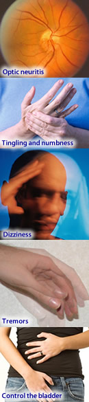 MS symptoms
