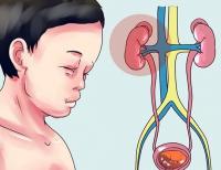 Nephrotic syndrome