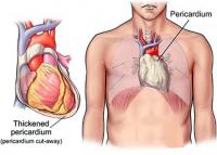 Pericardium
