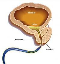Prostate