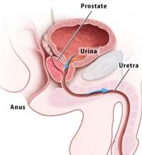 Prostate