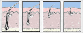 Reducing size of follicles