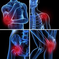 Shoulder bursitis symptoms