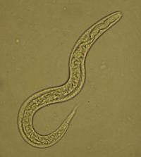 Strongyloides stercoralis
