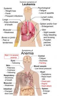 Symptoms of anemia and leukemia